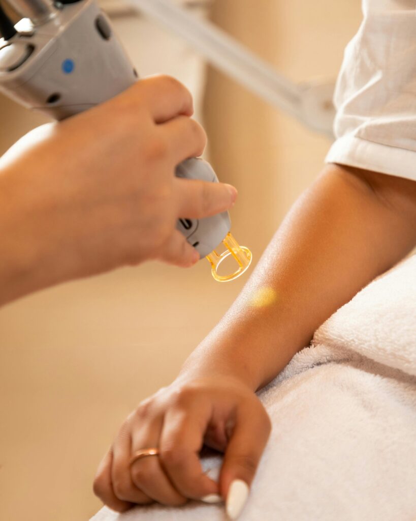 Tattoo Removal Tattoo Removal